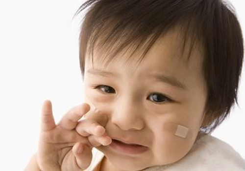 兒童過(guò)敏不同階段的表現(xiàn)